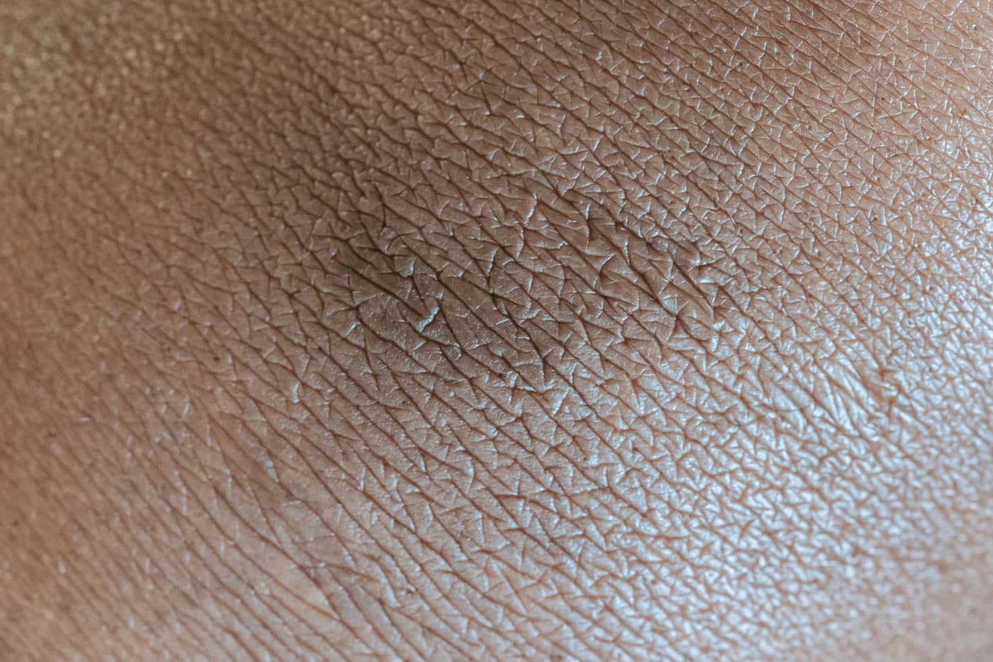 Close crop of dry skin texture under hard directional light